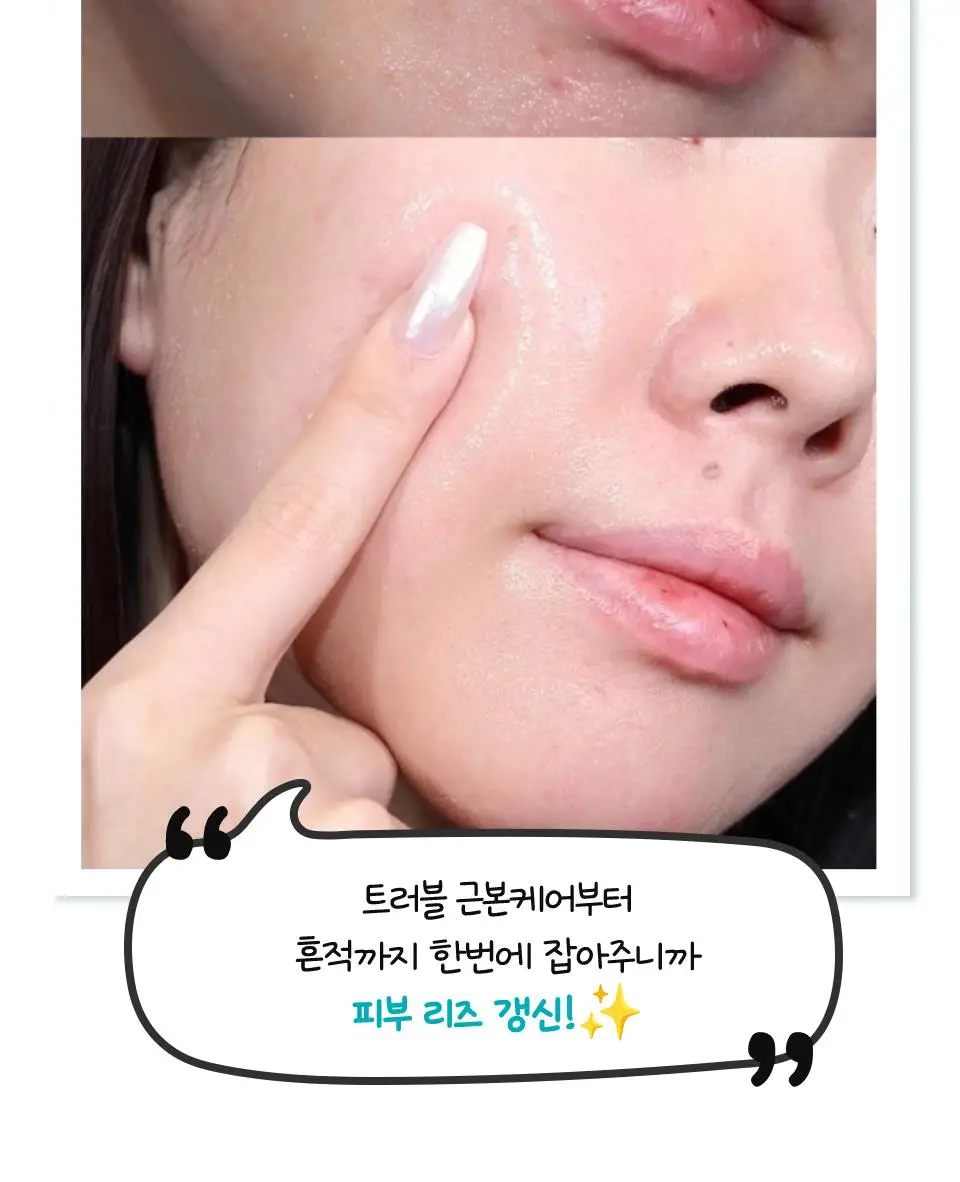[대용량/흔적리셋] 아이소이 브라이트닝 카밍 스팟 세럼 35ml 리필 기획(+35ml) 상세페이지 6